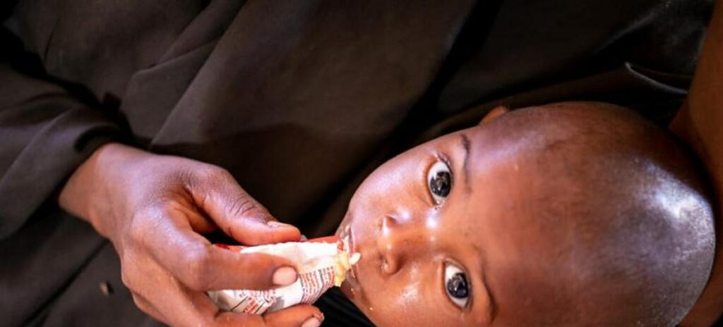 Níveis catastróficos de fome deixam 500 mil crianças em risco de morrer na Somália