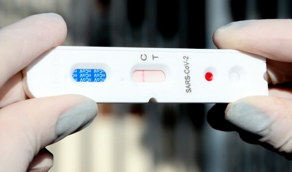 Saúde atualiza cronograma de testagem para Covid-19