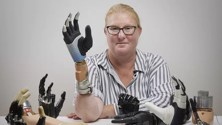 Britânico nascido sem mão obtém braço biônico inspirado em jogo eletrônico  - HOSPITAIS BRASIL